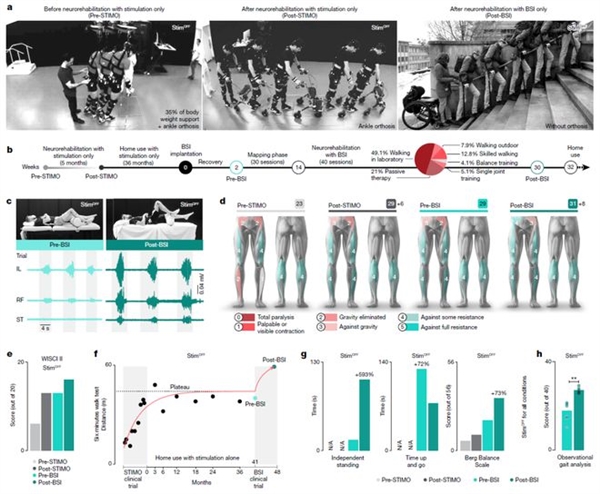 突破！脑脊接口让瘫痪者恢复独立行走
