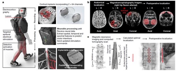 突破！脑脊接口让瘫痪者恢复独立行走
